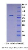 Mouse Signal Transducer And Activator Of Transcription 2 (STAT2) Protein