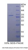 Human Signal Transducer And Activator Of Transcription 2 (STAT2) Protein
