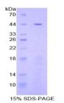 Rat Signal Transducer and Activator of Transcription 3 (STAT3) Protein