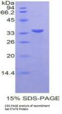 Rat Signal Transducer And Activator Of Transcription 6 (STAT6) Protein