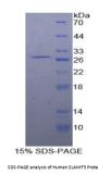 Human Signaling Lymphocytic Activation Molecule Family, Member 5 (SLAMF5) Protein