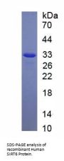 Human Sirtuin 6 (SIRT6) Protein
