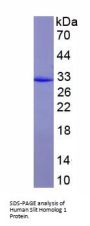 Human Slit Homolog 1 (SLIT1) Protein