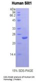 Human Slit Homolog 1 (Slit1) Protein