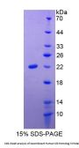 Human Slit Homolog 3 (SLIT3) Protein