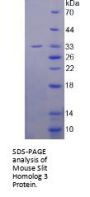 Mouse Slit Homolog 3 (SLIT3) Protein
