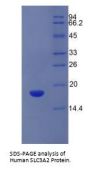 Human 4F2 Cell-Surface Antigen Heavy Chain (SLC3A2) Protein