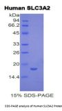 Human 4F2 Cell-Surface Antigen Heavy Chain (SLC3A2) Protein