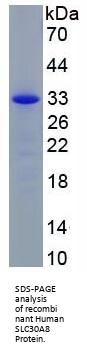 Human Solute Carrier Family 30 Member 8 (SLC30A8) Protein