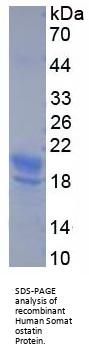 Human Somatostatin (SST) Protein