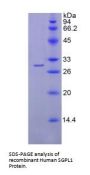 Human Sphingosine 1 Phosphate Lyase 1 (SGPL1) Protein