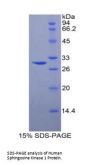 Human Sphingosine Kinase 1 (SPHK1) Protein