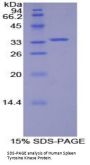 Human Spleen Tyrosine Kinase (SYK) Protein