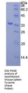 Mouse Spleen Tyrosine Kinase (SYK) Protein