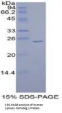 Human Sprouty Homolog 1 (SPRY1) Protein