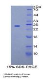 Human Sprouty Homolog 2 (SPRY2) Protein