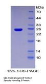 Human Sprouty Homolog 3 (SPRY3) Protein