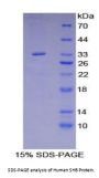 Human Src Homology 2 Domain Containing Adapter Protein B (SHB) Protein