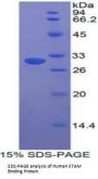 Human STAM Binding Protein (STAMBP) Protein