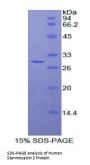 Human Stanniocalcin 2 (STC2) Protein