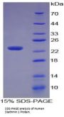 Human Stathmin 1 (STMN1) Protein