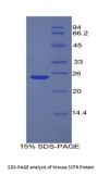 Mouse Mast/Stem Cell Growth Factor Receptor Kit (KIT) Protein