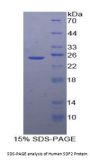 Human Stromal Cell Derived Factor 2 (SDF2) Protein