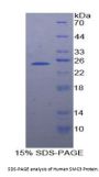 Human Structural Maintenance Of Chromosomes Protein 3 (SMC3) Protein
