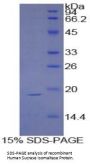 Human Sucrase Isomaltase (SI) Protein