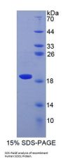 Human Superoxide Dismutase 1 (SOD1) Protein