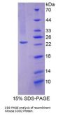 Mouse Superoxide Dismutase 2 (SOD2) Protein