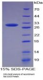 Rat Superoxide Dismutase 3 (SOD3) Protein