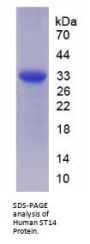Human Suppression Of Tumorigenicity 14 (ST14) Protein