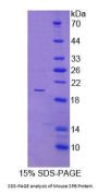 Mouse Pulmonary Surfactant-Associated Protein B (SFTPB) Protein