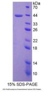 Human Pulmonary Surfactant-Associated Protein D (SFTPD) Protein