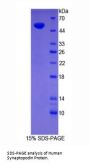 Human Synaptopodin (SYNPO) Protein