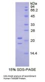 Human TAR DNA-Binding Protein 43 / TDP43 (TARDBP) Protein