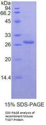 Mouse T-Cell Immunoreceptor with Ig and ITIM Domains (TIGIT) Protein