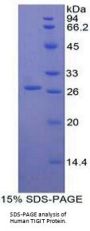 Human T-Cell Immunoreceptor with Ig and ITIM Domains (TIGIT) Protein