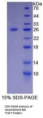 Rat T-Cell Immunoreceptor with Ig and ITIM Domains (TIGIT) Protein