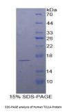 Human T-Cell Leukemia/Lymphoma Protein 1A (TCL1A) Protein