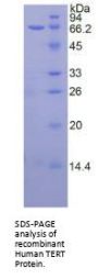 Human Telomerase Reverse Transcriptase (TERT) Protein