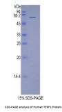 Human Telomeric Repeat-Binding Factor 1 (TERF1) Protein