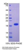 Human Thrombomodulin (THBD) Protein