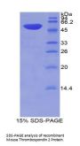 Mouse Thrombospondin 2 (THBS2) Protein