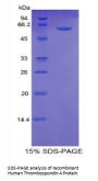 Human Thrombospondin 4 (THBS4) Protein