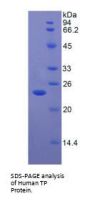 Human Thymidine Phosphorylase (TP) Protein