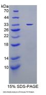 Mouse Thymidine Phosphorylase (TP) Protein