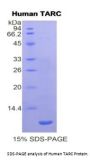 Human Thymus Activation Regulated Chemokine (TARC) Protein