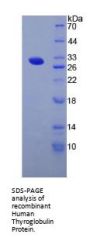 Human Thyroglobulin (TG) Protein